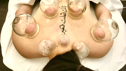 Image for Extended Subsequent Acupuncture with Acupressure 60min